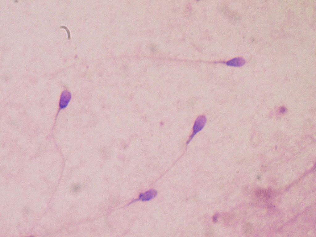 Imagen: Espermatozoides humanos coloreados para determinar la calidad del semen en el laboratorio clínico (Fotografía cortesía de Wikimedia Commons)