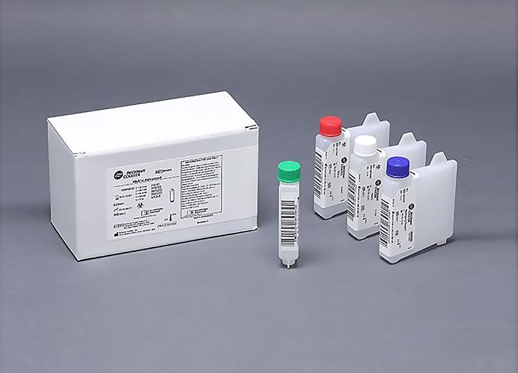 Imagen: Ensayo de HbA1c para diabetes usando química clínica avanzada: para diagnosticar la diabetes juvenil de inicio en la madurez (MODY), se deben realizar la detección de al menos tres autoanticuerpos y la prueba de HbA1c en todos los jóvenes en el momento del diagnóstico de diabetes (Fotografía cortesía de Beckman Coulter)