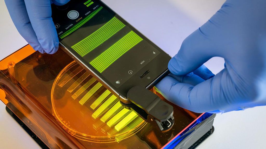 Imagen: La cámara de un teléfono inteligente es un componente importante del nuevo sistema de análisis para la detección de E. coli en muestras de orina (Fotografía cortesía de la Universidad de Bath)