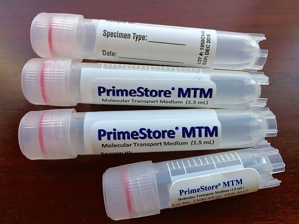 Imagen: El Medio de Transporte Molecular PrimeStore (MTM) es el primer dispositivo de transporte molecular diseñado para inactivar patógenos y estabilizar tanto el ARN como el ADN para la prueba y la caracterización molecular aguas abajo (Fotografía cortesía de Longhorn Vaccines and Diagnostics).