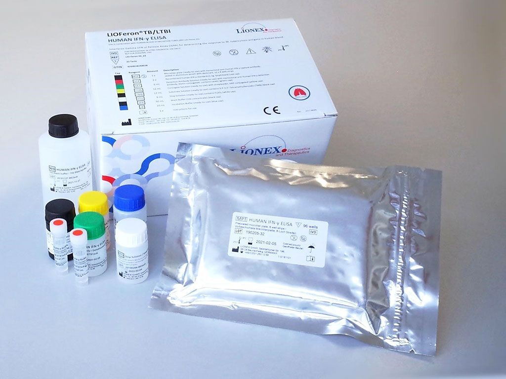 Imagen: La prueba LIOFeronTB/LTBI es una prueba nueva de liberación de interferón gamma para diagnosticar la infección latente de tuberculosis (LTBI)/TB (Fotografía cortesía de Lionex GmbH).