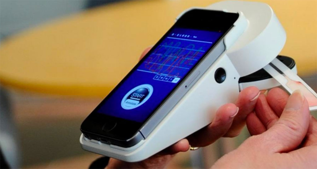 Imagen: Nuevo método de prueba rápido que detecta antígenos virales puede diagnosticar la COVID-19 en etapa temprana (fotografía cortesía de Centro de Investigación Técnica VTT de Finlandia Ltd.) Imagen: Nuevo método de prueba rápido que detecta antígenos virales puede diagnosticar la COVID-19 en etapa temprana (fotografía cortesía de Centro de Investigación Técnica VTT de Finlandia Ltd.)