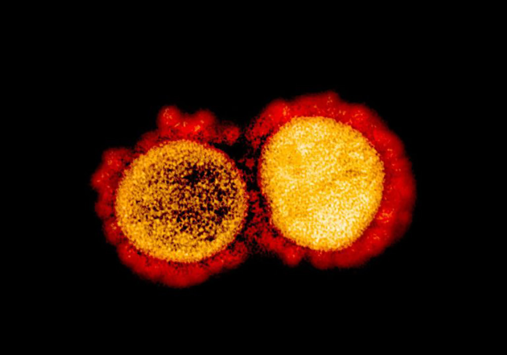 Imagen: Esta micrografía electrónica de transmisión muestra partículas de virus SARS-CoV-2 aisladas de un paciente que padece COVID-19 (Fotografía cortesía del NIAID). Imagen: Esta micrografía electrónica de transmisión muestra partículas de virus SARS-CoV-2 aisladas de un paciente que padece COVID-19 (Fotografía cortesía del NIAID).