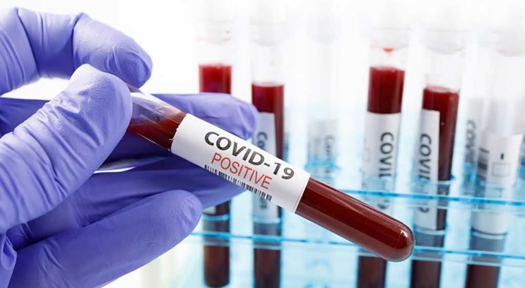 Imagen: La detección de anticuerpos es crítica para el diagnóstico de la COVID-19 (Fotografía cortesía del Departamento de Salud de Minnesota).