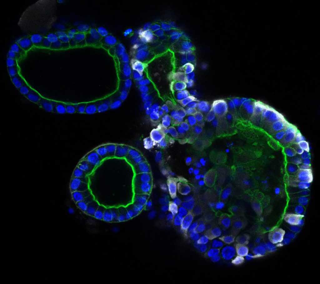 Imagen: Organoides intestinales: el derecho infectado con coronavirus SARS-CoV-2 (Fotografía cortesía del Instituto Hubrecht) Imagen: Organoides intestinales: el derecho infectado con coronavirus SARS-CoV-2 (Fotografía cortesía del Instituto Hubrecht)