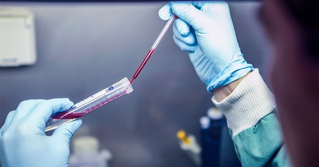 Imagen: Se ha desarrollado un nuevo análisis de sangre para detectar la exposición reciente a la malaria ‘recurrente’ o vivax (Fotografía cortesía de Mayeta Clark, Instituto Walter y Eliza Hall, Australia).