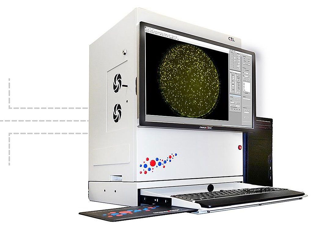 Imagen: Los analizadores CTL-Immunospot vienen en una amplia gama de modelos, cada uno de ellos diseñado para hacer que el análisis de ensayos sea más rápido, más fácil y más exacto que nunca (Fotografía cortesía de Cellular Technology Limited).