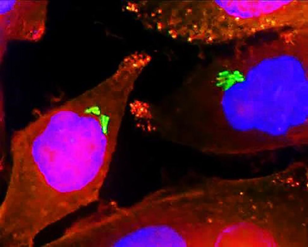 Imagen: Bacterias (verdes) dentro de las células de cáncer de páncreas humano (células AsPC-1). Los núcleos celulares se colorean de azul mientras que su citoplasma se colorea de naranja (Fotografía cortesía del Instituto de Ciencias Weizmann).