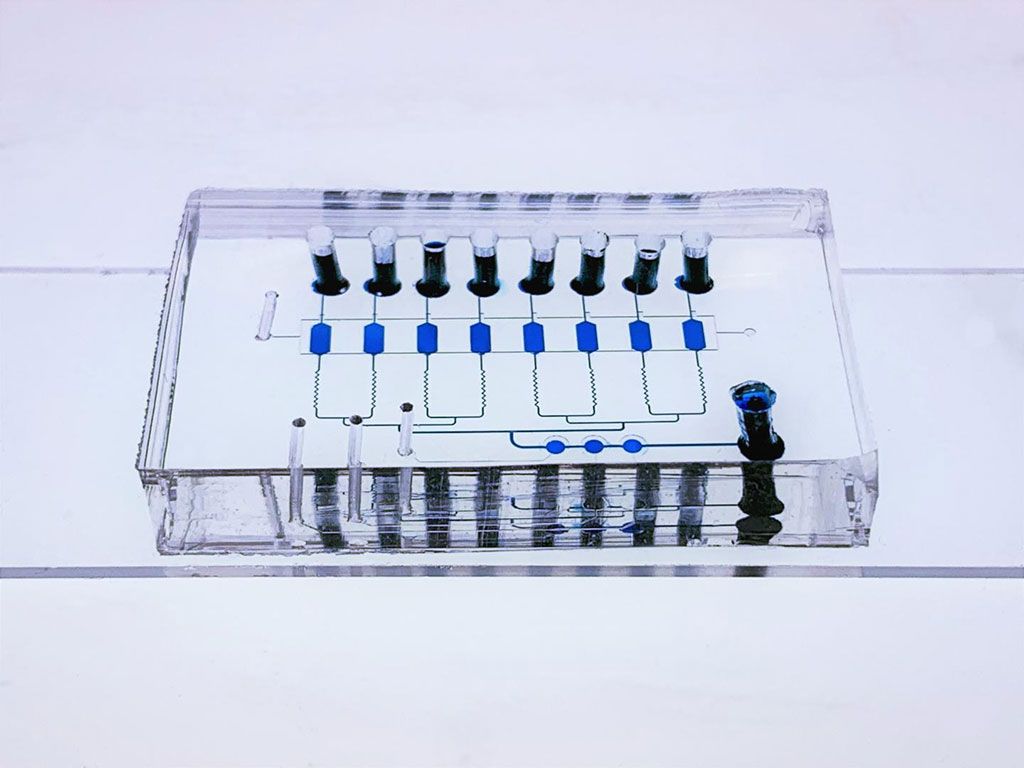 Imagen: El dispositivo de chip EV-CLUE multicapa. Los microrreactores y los canales de conexión se visualizan llenándolos con colorante azul para alimentos. El portaobjetos de vidrio inferior está modelado con estructuras de nanopartículas y recubierto con anticuerpos para capturar vesículas extracelulares (Fotografía cortesía del Dr. Yong Zeng)