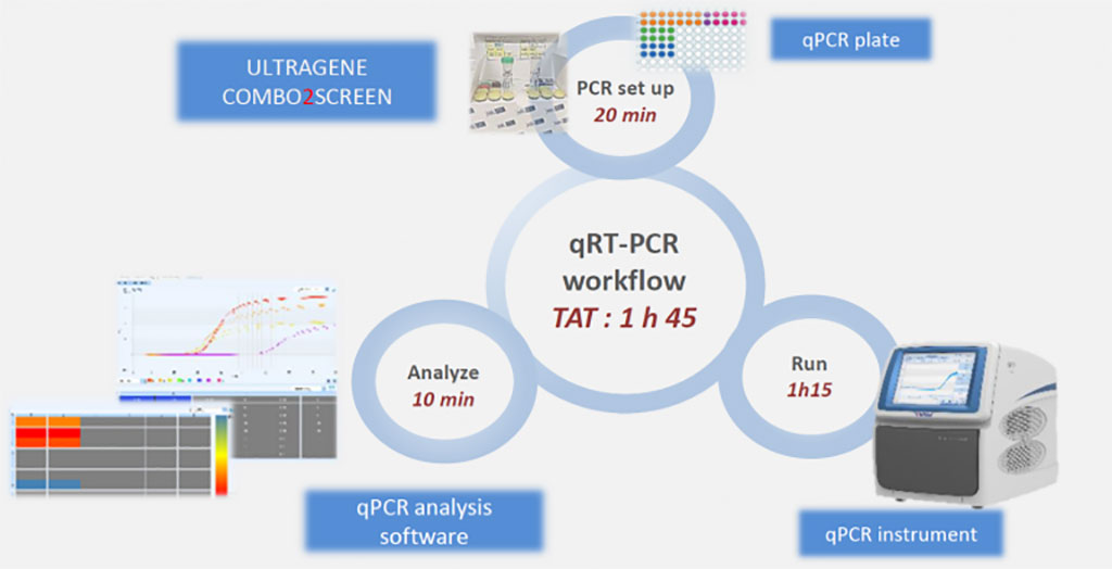 Imagen: Flujo de trabajo qRT-PCR (Fotografía cortesía de Advanced Biological Laboratories)