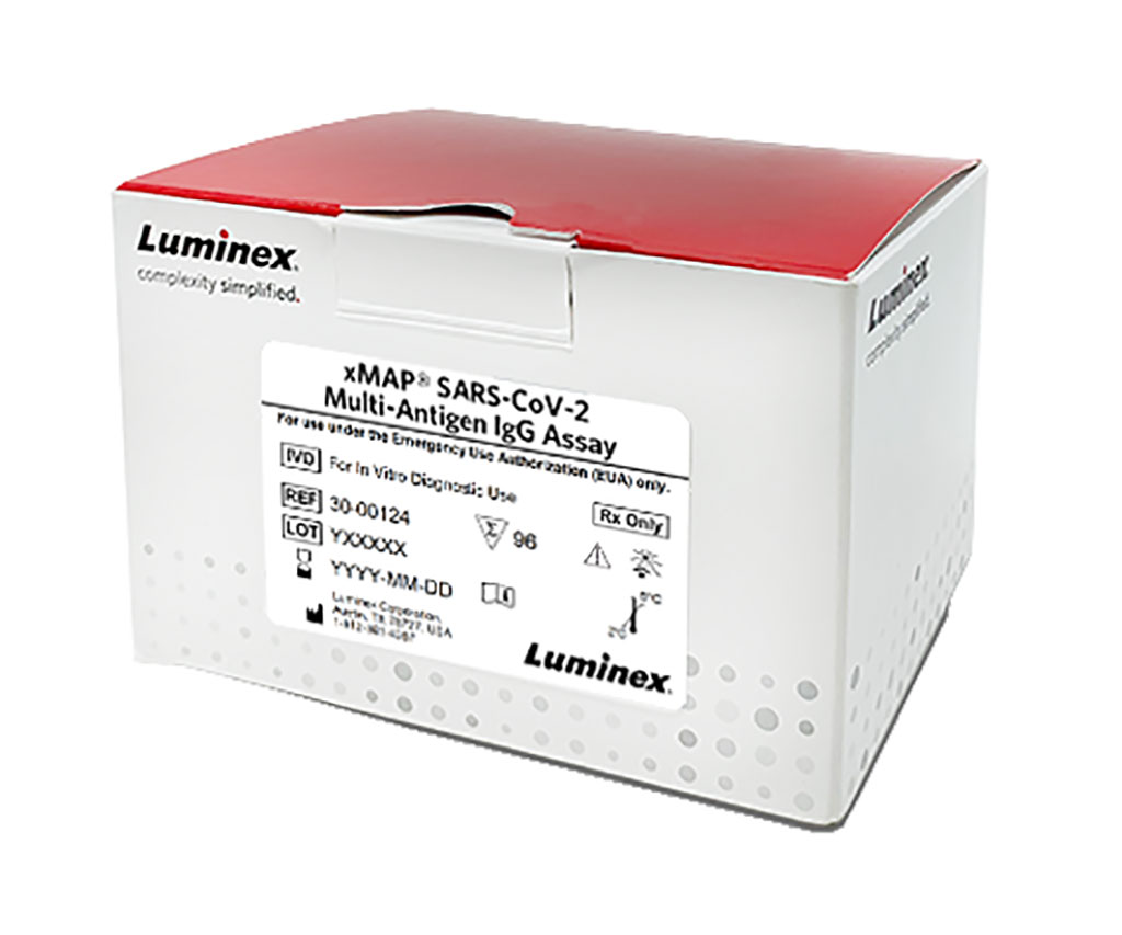 Imagen: Análisis xMAP SARS-CoV-2 Multi-Antigeno IgG (Fotografía cortesía de Luminex Corporation) Imagen: Análisis xMAP SARS-CoV-2 Multi-Antigeno IgG (Fotografía cortesía de Luminex Corporation)