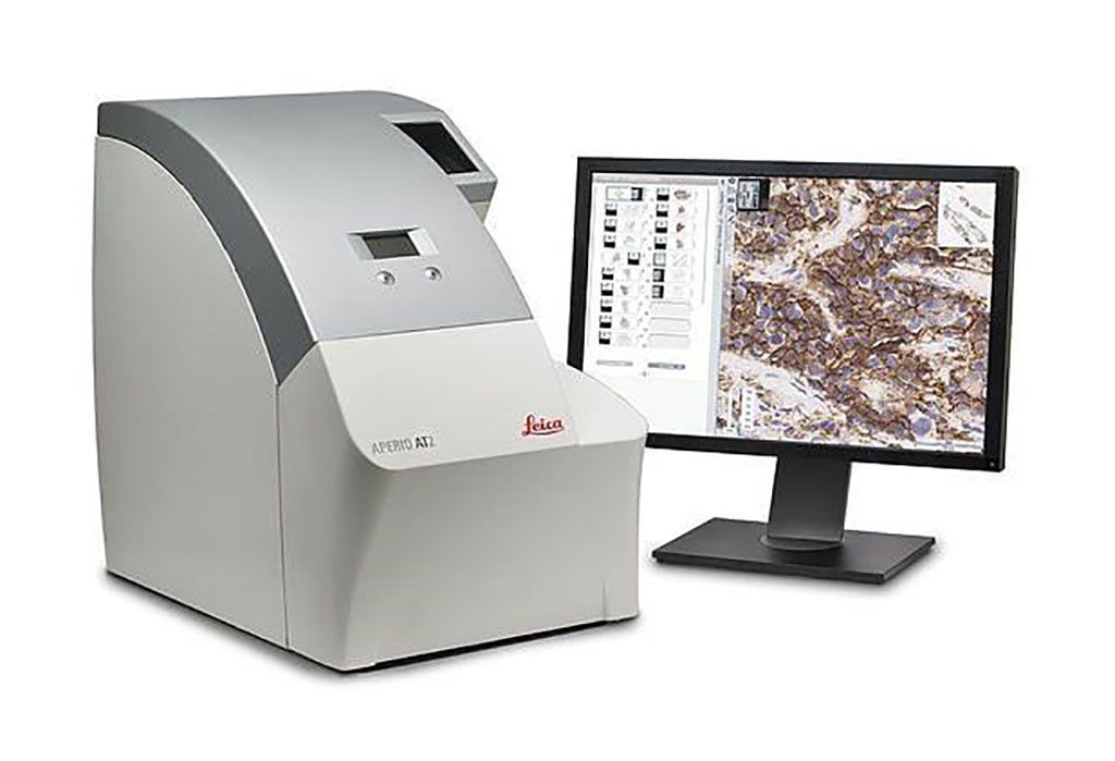 Imagen: El Aperio AT2 es el escáner ideal de láminas de patología digital para los laboratorios clínicos de alto rendimiento, que ofrecen láminas electrónicas precisas con baja tasa de reescaneo (Fotografía cortesía de Leica Biosystems).