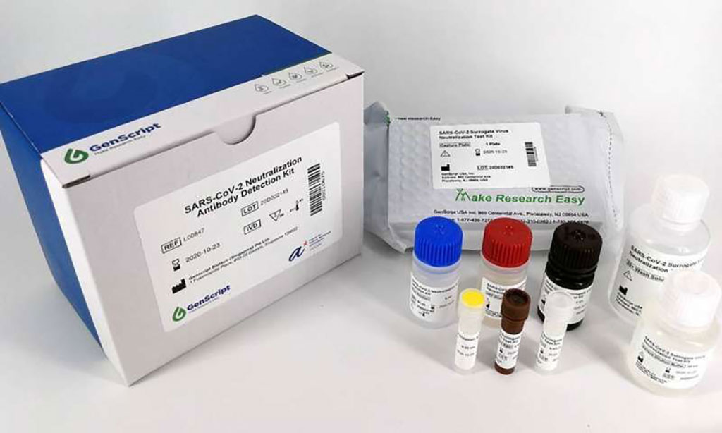 Imagen: Kit de detección de anticuerpos neutralizantes del SARS-CoV-2 (Fotografía cortesía de GenScript Biotech)
