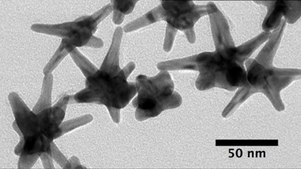Imagen: Micrografía de biosensores de nanoestrellas de oro utilizados para detectar microARN relacionados con el cáncer (Fotografía cortesía de la Facultad de Ingeniería de la Universidad de Duke)