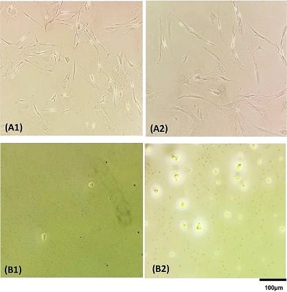 Imagen: Células en los pozos de una placa de 96 pozos antes (A) y después (B) de lisis celular, mediante PCR directa (B1) y Chelex100 (B2) (Fotografía cortesía del Hospital Universitario de Hamburgo ‐ Eppendorf).