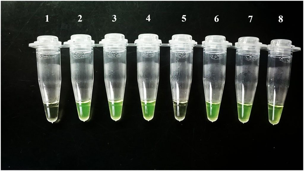 Imagen: Visualización de los resultados de la prueba Loopamp Trypanosoma cruzi a simple vista, los tubos 1 (control negativo) y 5 fueron negativos, pero el # 5 fue positivo en la qPCR con una carga de ADN muy baja (Fotografía cortesía del Laboratorio de Biología Molecular de la Enfermedad de Chagas).