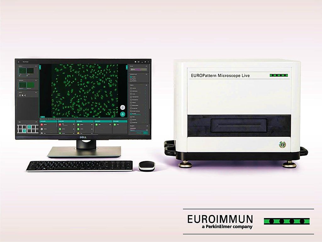 Imagen: EUROPattern Microscope Live: microscopía de fluorescencia ultrarrápida que detecta automáticamente anticuerpos anticitoplasma de neutrófilos (Fotografía cortesía de EUROIMMUN AG).