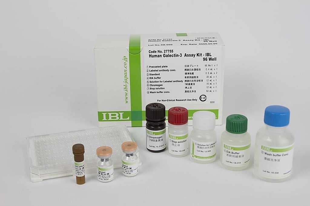 Imagen: Un kit de ELISA para la galectina-3 que puede predecir eventos cardiovasculares en pacientes con diabetes tipo 2 (Fotografía cortesía de Immuno-Biological Laboratories).