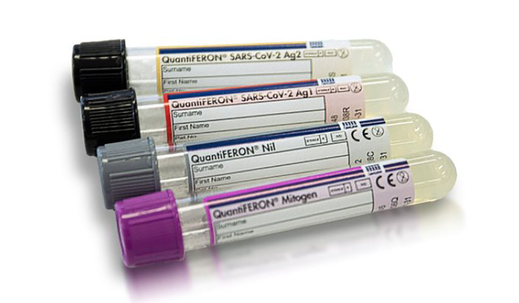 Imagen: Solución QuantiFERON SARS-CoV-2 RUO (para uso en investigación únicamente) de QIAGEN (Fotografía cortesía de QIAGEN N.V.)