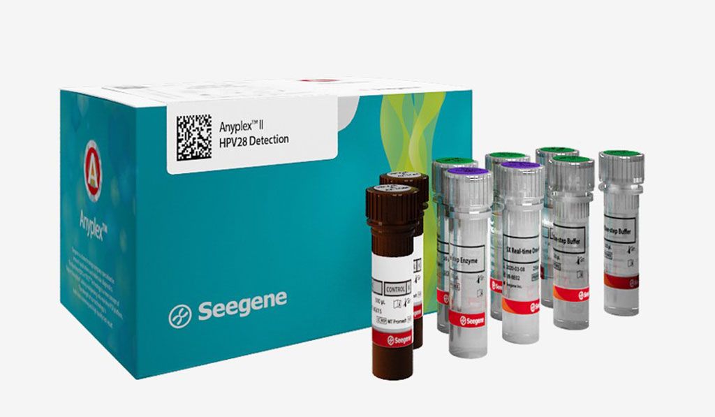 Imagen: El kit de detección Anyplex II HPV28 detecta e identifica simultáneamente 28 tipos de VPH (19 de alto riesgo y 9 de bajo riesgo) (Fotografía cortesía de Seegene).