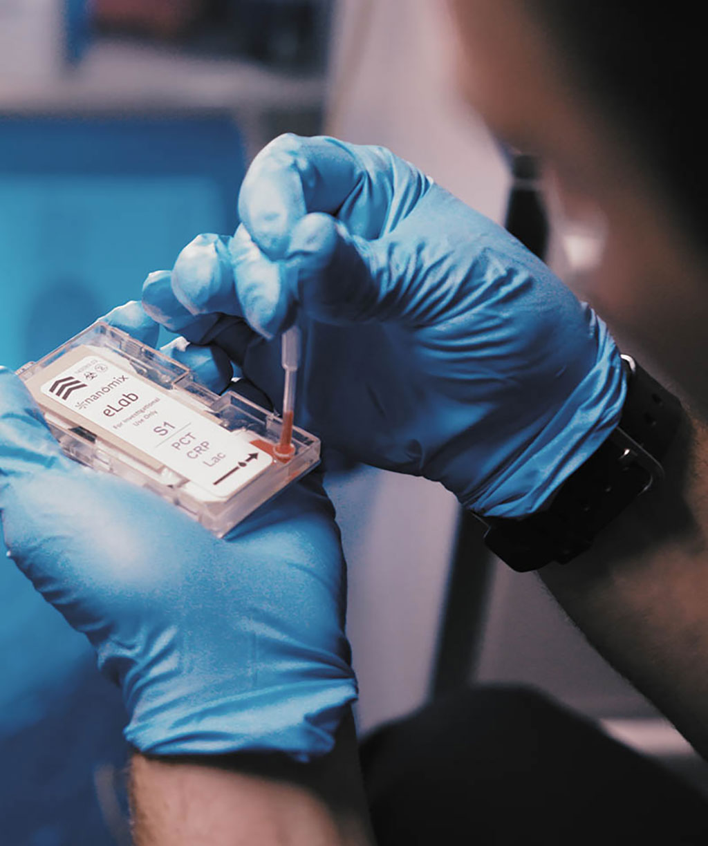 Imagen: Analizador Nanomix eLab (Fotografía cortesía de Nanomix, Inc.) Imagen: Analizador Nanomix eLab (Fotografía cortesía de Nanomix, Inc.)