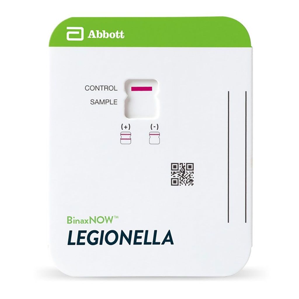 Imagen: La tarjeta de antígeno urinario BinaxNOW Legionella. Exacta. Identificación rápida de la enfermedad del legionario causada por Legionella pneumophila serogrupo 1 con una tecnología fácil de usar (Fotografía cortesía de Abbott).