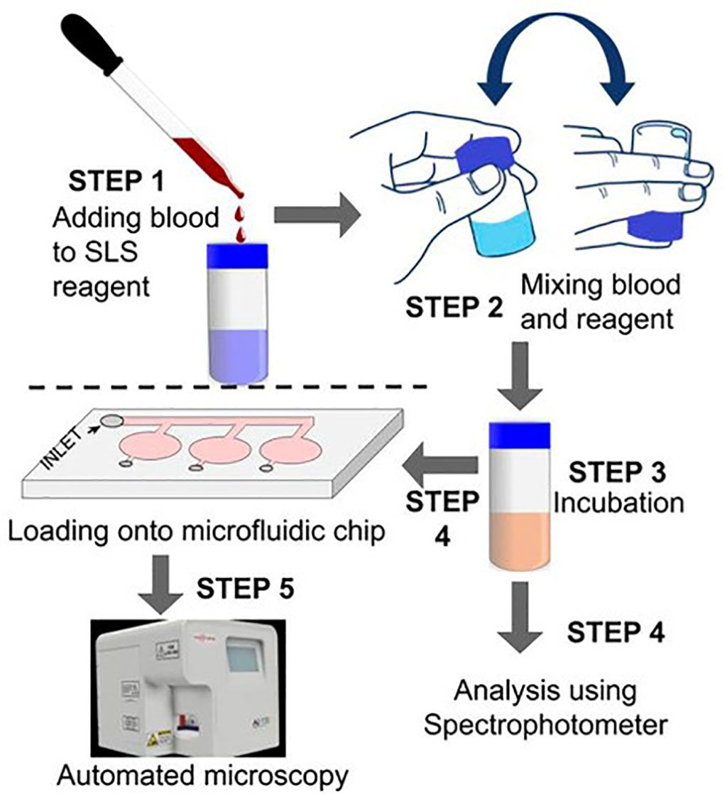 Imagen: Flujo de trabajo para la determinación de hemoglobina utilizando un microscopio automatizado (Fotografía cortesía de Sigtuple Technologies).