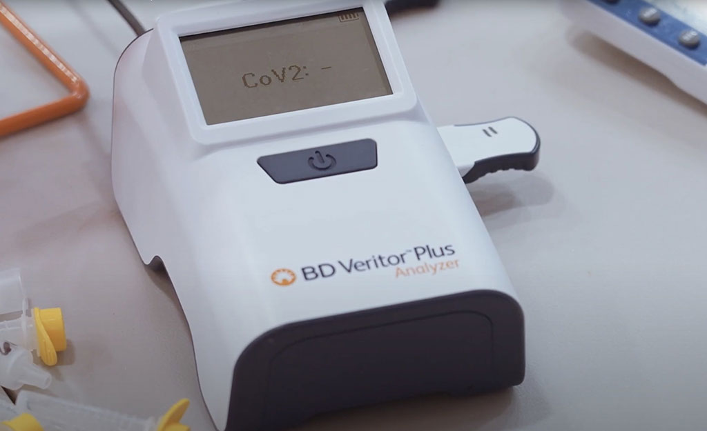 Imagen: El sistema BD Veritor Plus para la detección rápida del SARS-CoV-2 (Fotografía cortesía de Becton, Dickinson and Company)