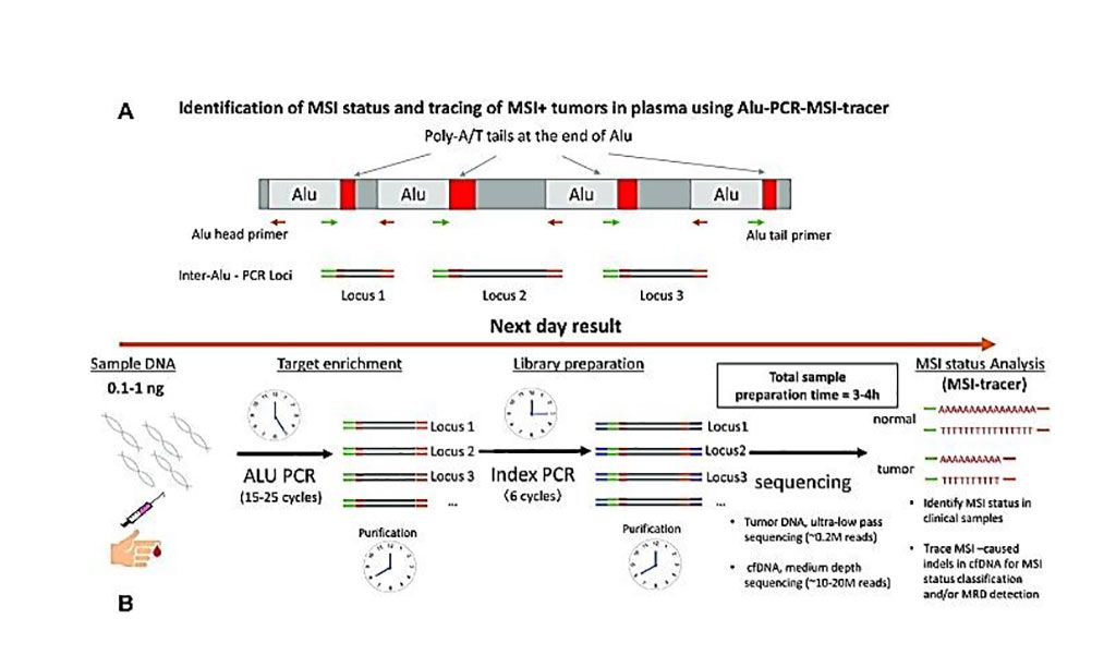 Imagen: Diagrama esquemático para la identificación de estado de MSI y rastreo de tumores MSI+ en plasma con el trazador Alu-PCR-MSI (Fotografía cortesía del Instituto de Cáncer Dana-Farber)