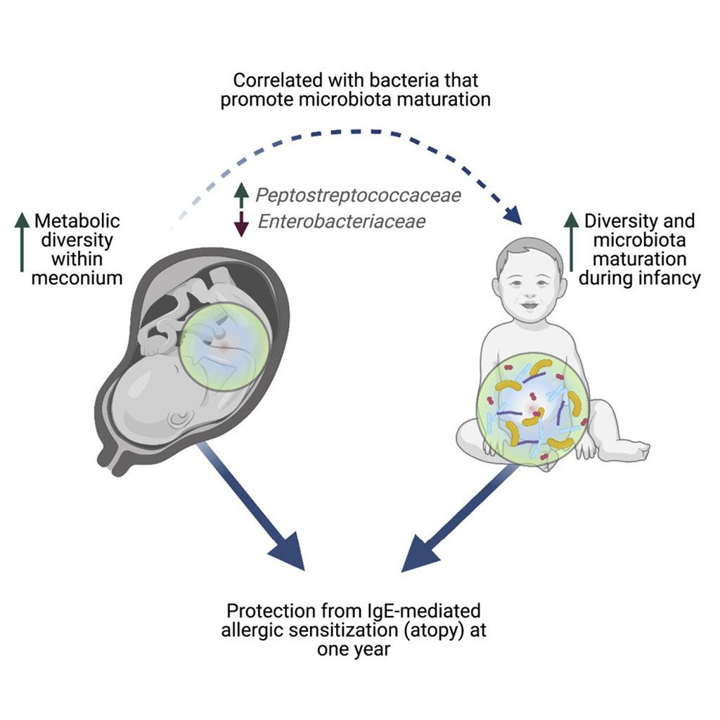 Imagen: El diagrama esquemático de un metaboloma rico en meconio en bebés humanos está asociado con la composición de la microbiota intestinal en la vida temprana y la sensibilización alérgica reducida (Fotografía cortesía de la Universidad de la Columbia Británica)