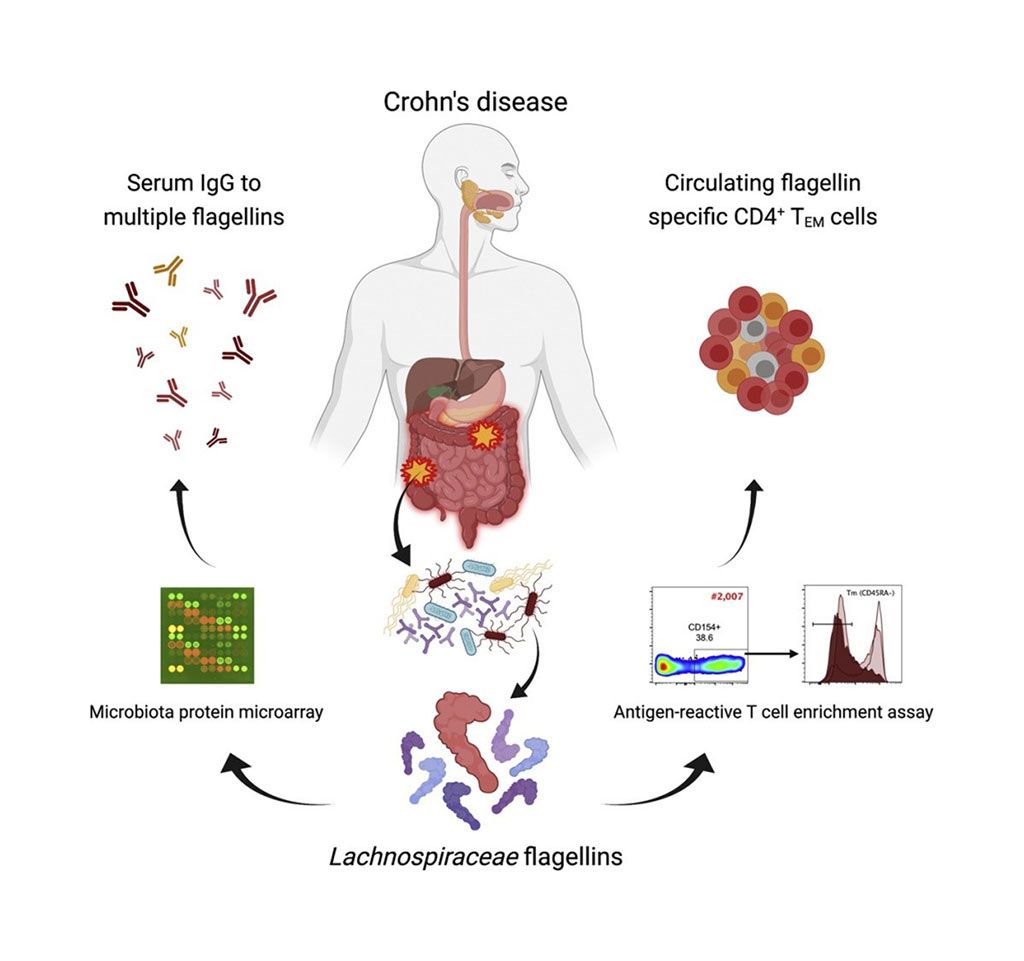 Imagen: Diagrama esquemático de cómo las flagelinas de la microbiota humana impulsan las respuestas inmunitarias adaptativas en la enfermedad de Crohn (Fotografía cortesía de la Universidad de Alabama en Birmingham)