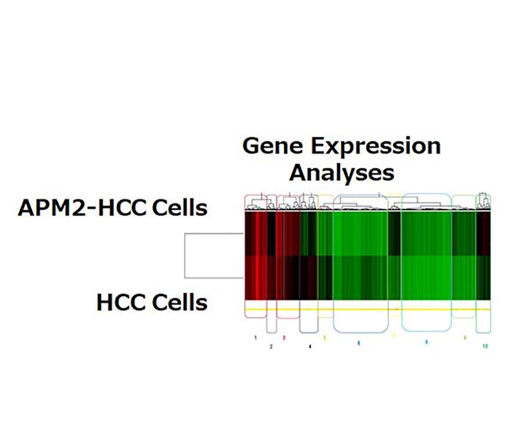 Imagen: La sobreexpresión de APM2 aumenta la expresión del gen ERCC6L (Fotografía cortesía de la Universidad de Niigata)