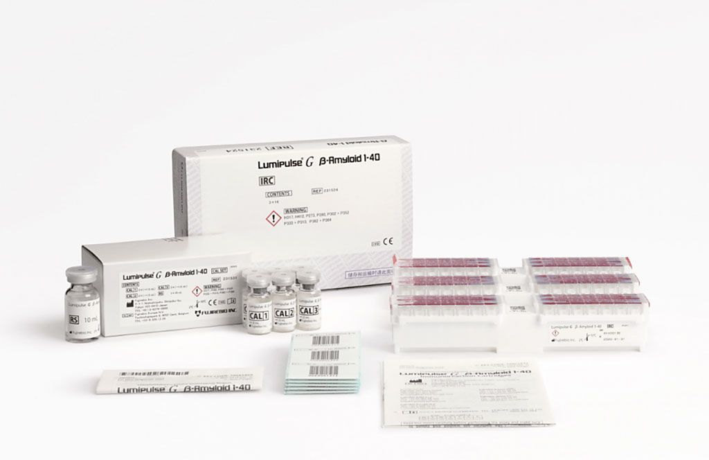 Imagen: El kit de análisis Lumipulse G β-amiloide 1-40 (Fotografía cortesía de Fujirebio)