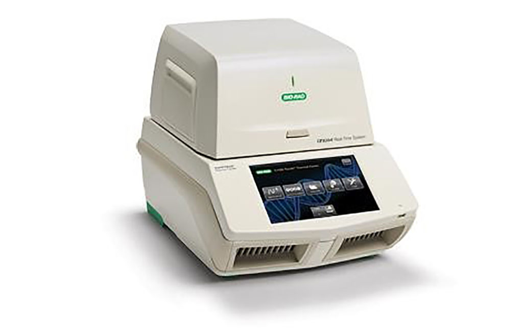 Imagen: El sistema de detección de PCR en tiempo real, CFX384 Touch (Fotografía cortesía de Bio-Rad)