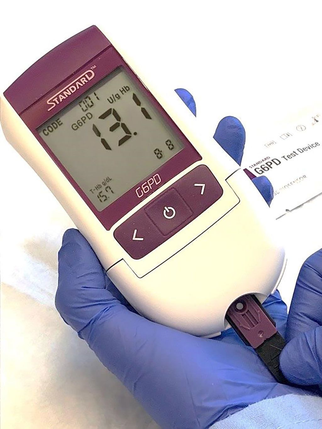 Imagen: La prueba STANDARD G6PD es un dispositivo de mano que ofrece resultados en dos minutos y proporciona una medida cuantitativa de la actividad de la G6PD, incluso en mujeres heterocigotas (Fotografía cortesía de SD BIOSENSOR/PATH)
