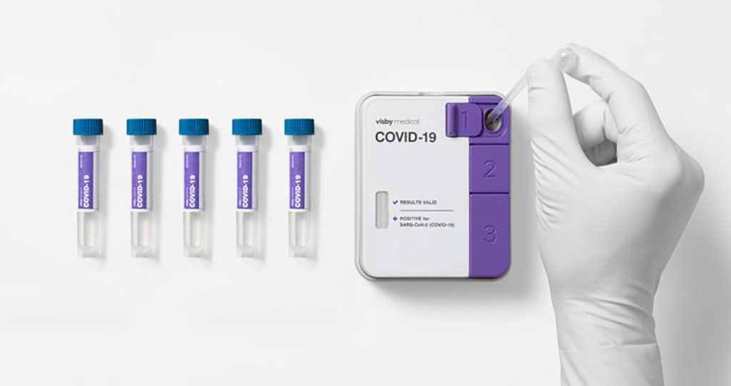Imagen: Primera prueba de RT-PCR para la COVID-19 sin instrumentos, que recibe la AUE por la FDA para muestras mezcladas (Fotografía cortesía de Visby Medical)