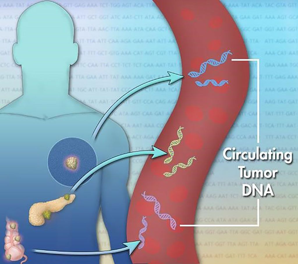 Imagen: El ADN tumoral circulante (ADNtc) se encuentra en el torrente sanguíneo y se refiere al ADN que proviene de células cancerosas y tumores. El ensayo LiquidHALLMARK, una prueba de biopsia líquida, rastrea los cambios en el ADNtc basados en el tratamiento (Fotografía cortesía de Jonathan Bailey, Instituto Nacional de Investigación del Genoma Humano)