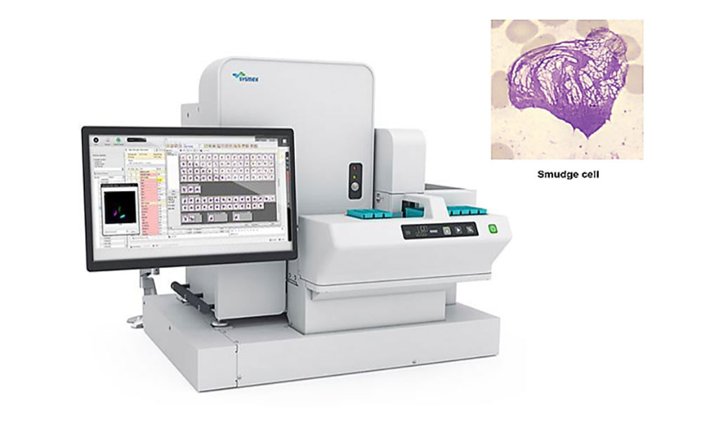 Imagen: El Sysmex DI-60 es un sistema automatizado de análisis de imágenes de localización de células. Está conectado directamente a la pista del analizador y, por lo tanto, elimina la necesidad de intervención manual en el flujo de trabajo de hematología en el ciclo de imágenes (Fotografía cortesía de Sysmex Corporation)