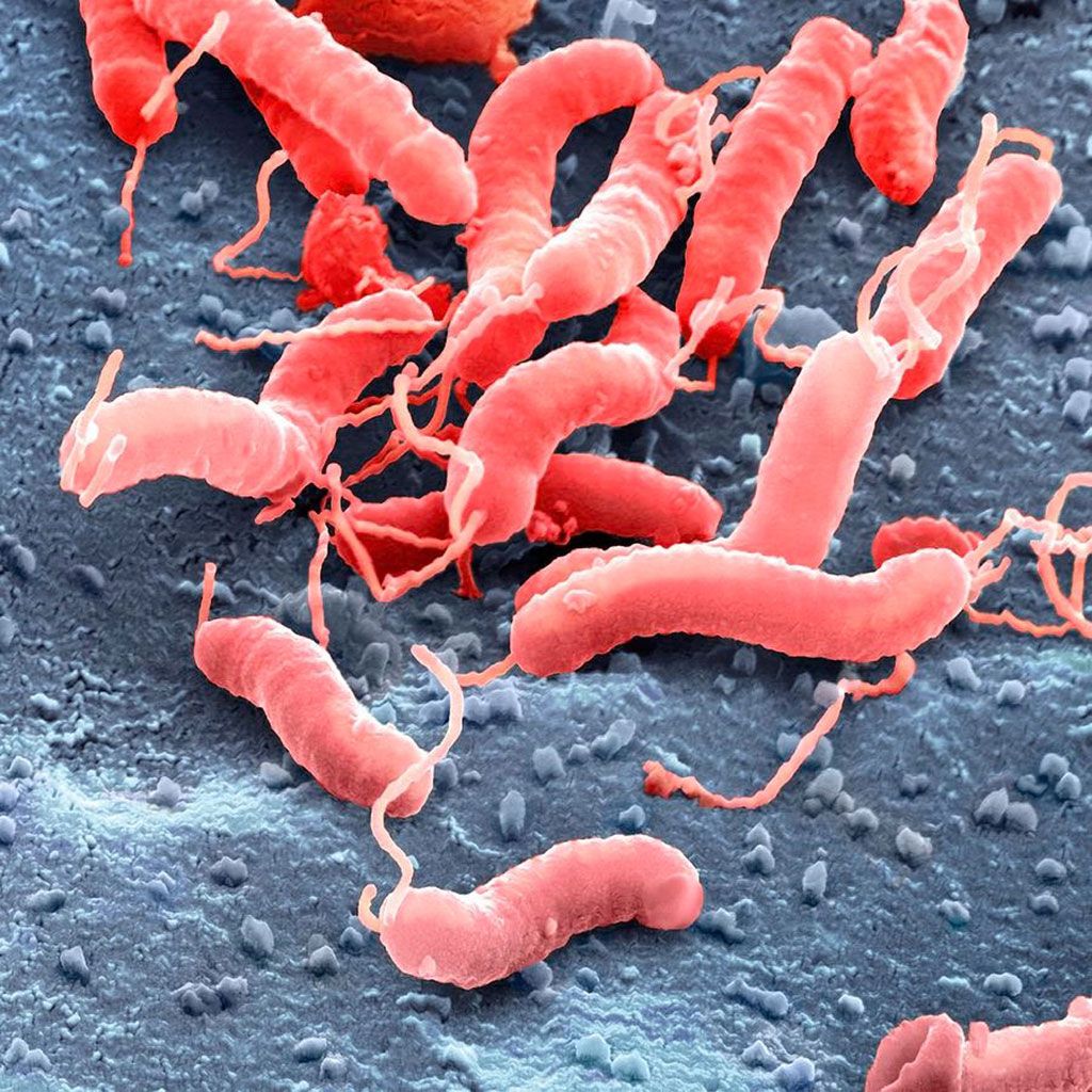 Imagen: Micrografía electrónica de barrido de Helicobacter pylori: la resistencia a los antibióticos se puede perfilar utilizando la secuenciación de próxima generación (Fotografía cortesía de Juergen Berger/Science Photo Library)
