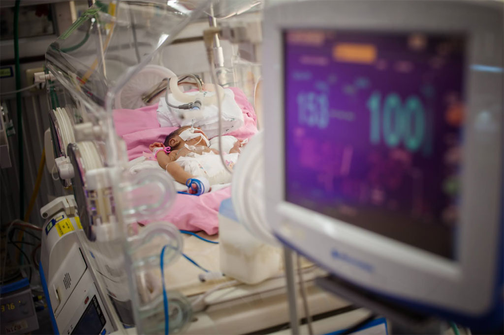 Imagen: Un bebé prematuro siendo monitoreado en una sala de cuidados intensivos neonatales (Fotografía cortesía de 123rf.com) Imagen: Un bebé prematuro siendo monitoreado en una sala de cuidados intensivos neonatales (Fotografía cortesía de 123rf.com)