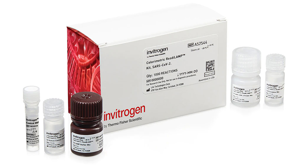 Imagen: Kit colorimétrico ReadiLAMP SARS-CoV-2 de Invitrogen (Fotografía cortesía de Thermo Fisher Scientific)