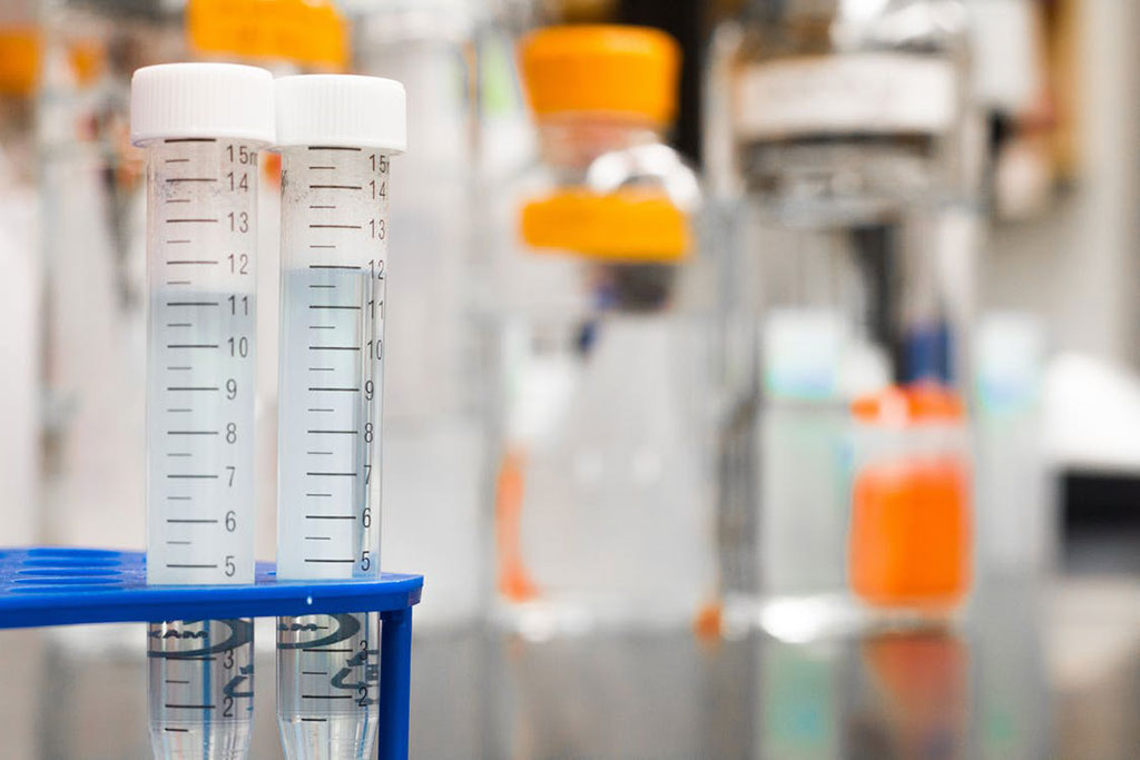 Imagen: Un nuevo método para desarrollar pruebas de diagnóstico podría ayudar a abordar futuras pandemias (Fotografía cortesía de Pexels) Imagen: Un nuevo método para desarrollar pruebas de diagnóstico podría ayudar a abordar futuras pandemias (Fotografía cortesía de Pexels)