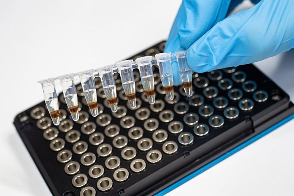 Imagen: La biopsia líquida abre nuevas posibilidades para un diagnóstico más temprano (Fotografía cortesía de la Universidad de Finlandia Oriental) Imagen: La biopsia líquida abre nuevas posibilidades para un diagnóstico más temprano (Fotografía cortesía de la Universidad de Finlandia Oriental)