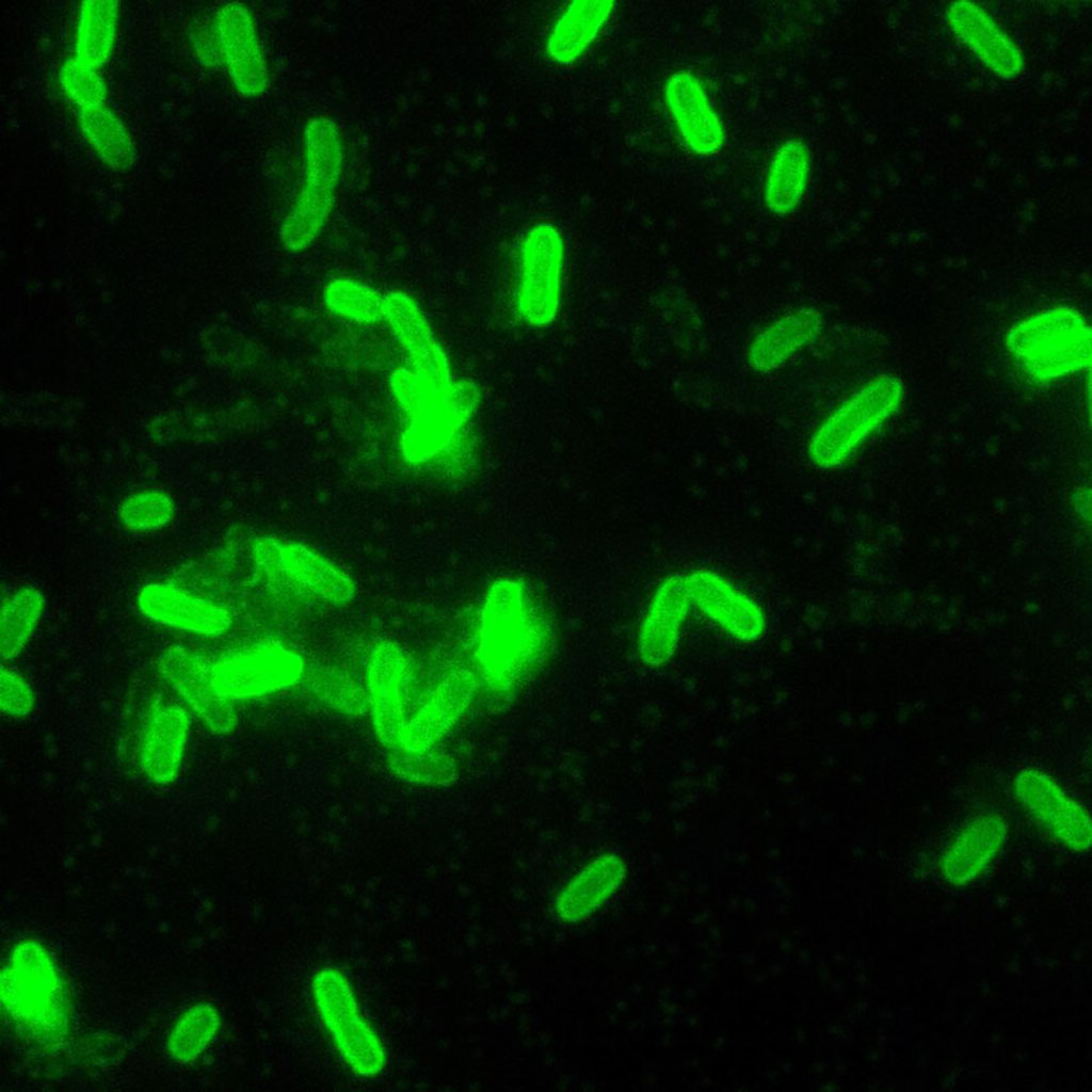Imagen: Microfotografía de la bacteria Yersinia pestis coloreada con anticuerpo fluorescente directo (Fotografía cortesía de Pixnio).
