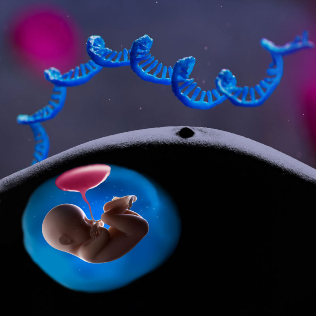 Imagen:  Plataforma Mirvie RNA predice complicaciones del embarazo meses antes de que ocurran (Fotografía cortesía de Mirvie)