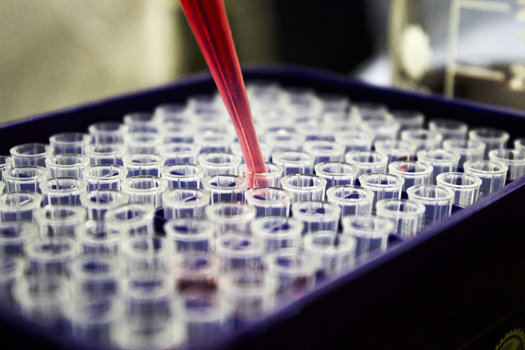Imagen: Análisis de sangre preciso, no invasivo y económico ayudará a diagnosticar el cáncer intestinal temprano (Fotografía cortesía de la Universidad de Swansea) Imagen: Análisis de sangre preciso, no invasivo y económico ayudará a diagnosticar el cáncer intestinal temprano (Fotografía cortesía de la Universidad de Swansea)