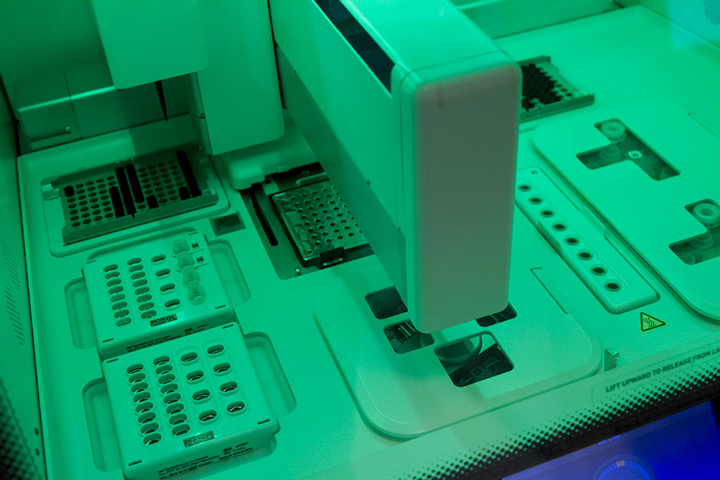 Imagen: Técnica no invasiva recolecta suficiente líquido lagrimal para buscar biomarcadores de salud y enfermedad (Fotografía cortesía de Unsplash)