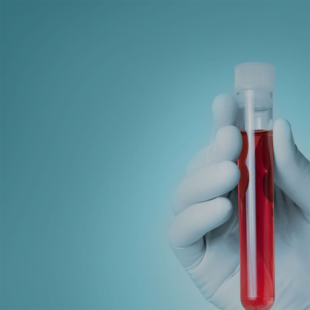 Imagen: Una nueva prueba de cáncer de pulmón para la detección temprana del cáncer de pulmón (Fotografía cortesía de Cizzle Biotechnology)