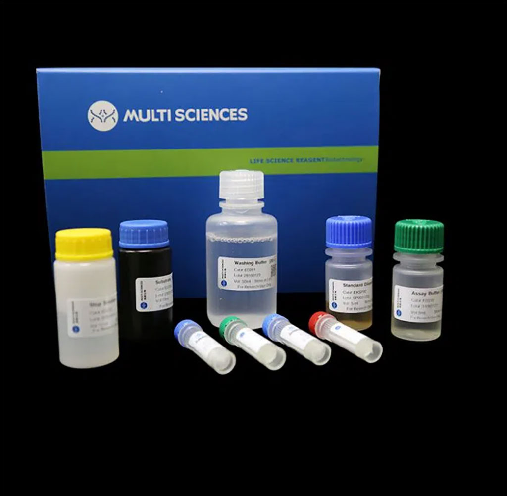 Imagen: El kit ELISA Human P-Selectin para determinar los niveles de vimentina sérica se correlacionaron positivamente con la selectina P en la sepsis pediátrica grave (Fotografía cortesía de MULTI SCIENCES(LIANKE) BIOTECH, CO.,LTD)
