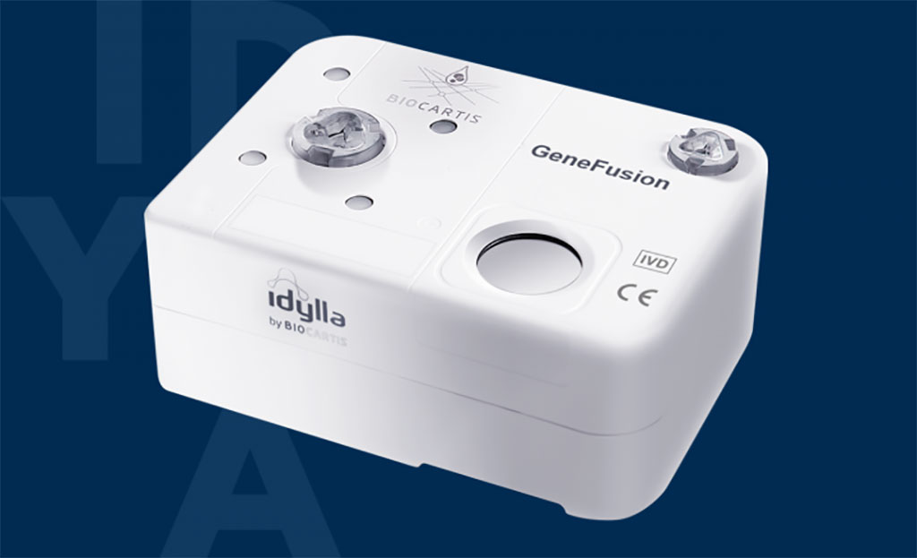 Imagen: El panel Idylla GeneFusion IVD con marca CE está destinado a decisiones rápidas de tratamiento en el cáncer de pulmón (Fotografía cortesía de Biocartis) Imagen: El panel Idylla GeneFusion IVD con marca CE está destinado a decisiones rápidas de tratamiento en el cáncer de pulmón (Fotografía cortesía de Biocartis)